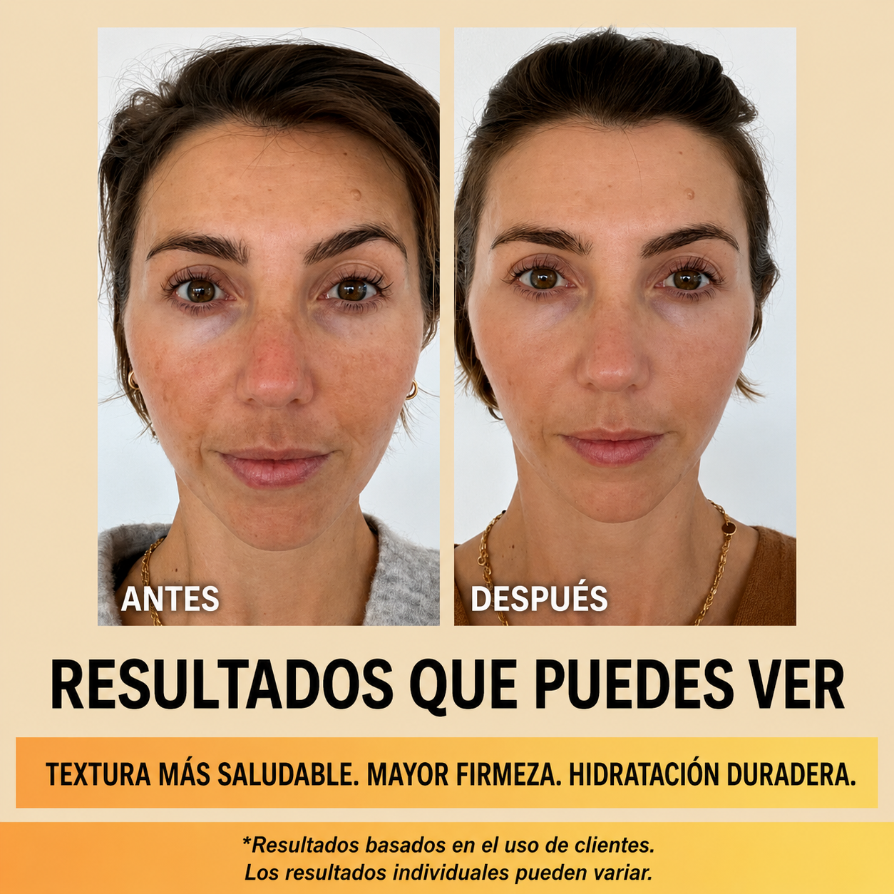 Centellian24 Madeca Cream