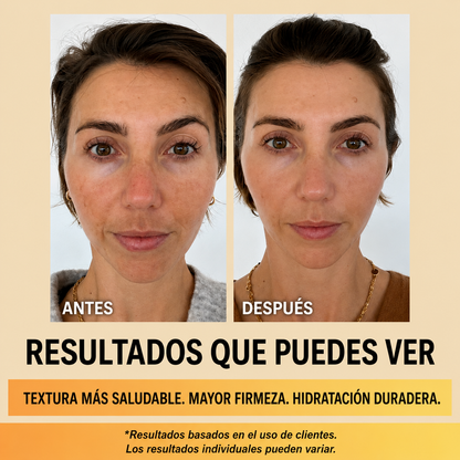Centellian24 Madeca Cream